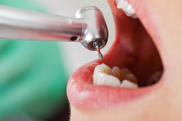 Best Dentist for Severe Toothache  in Glendale, MS